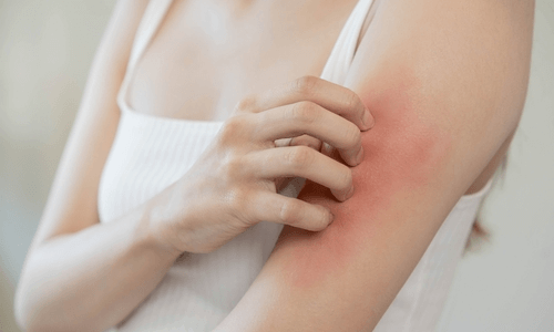 患者の重症度が低い