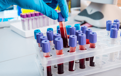 血液検査