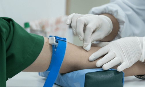 診察前の患者への尿検査や採血